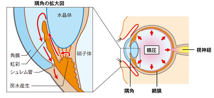 緑内障の仕組み