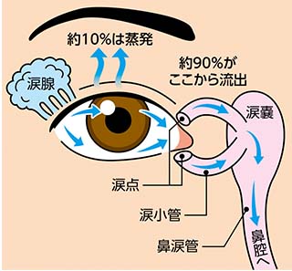 涙目の仕組みと治療イメージ画像